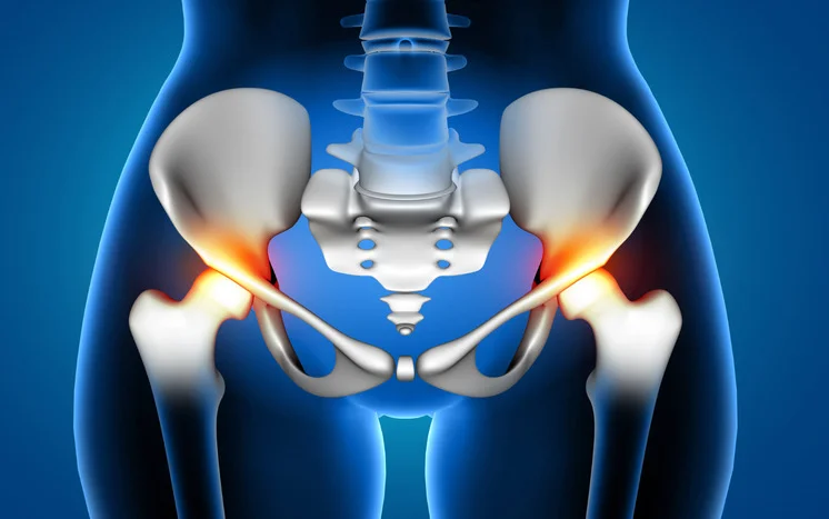 Hip replacement in india