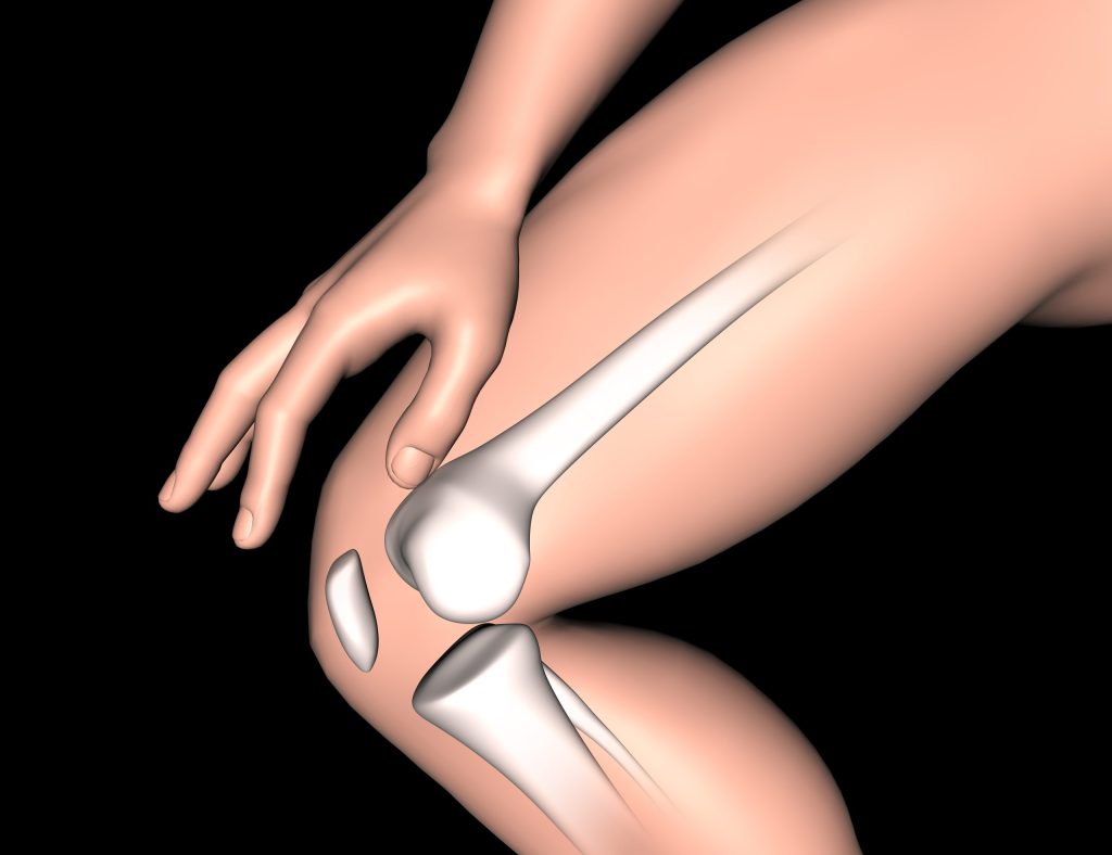 3D image of knee bone