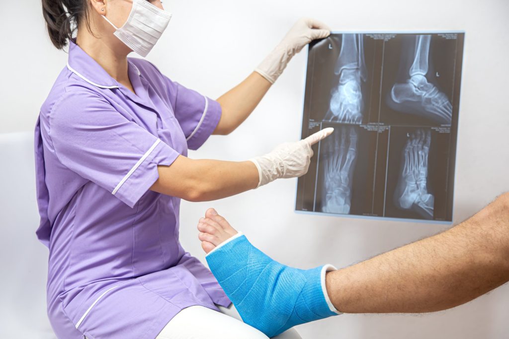 Bone fracture foot and leg on patient being examined by a doctor in a hospital.