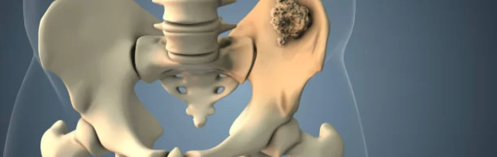 Hip Joint Anatomy 3d Illustration
