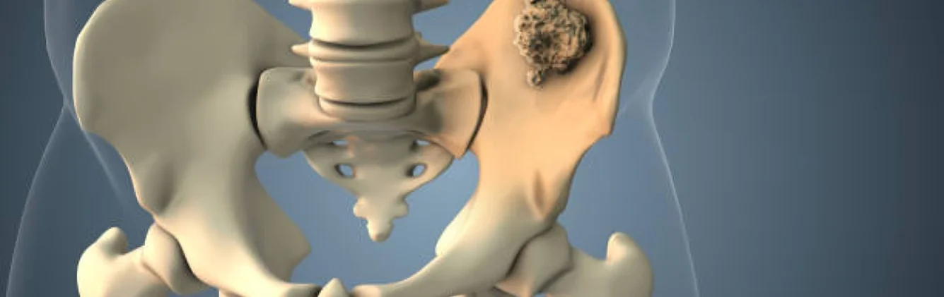 Hip Joint Anatomy 3d Illustration