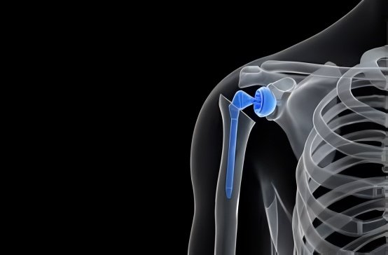 knee surgery tourism reviews in india