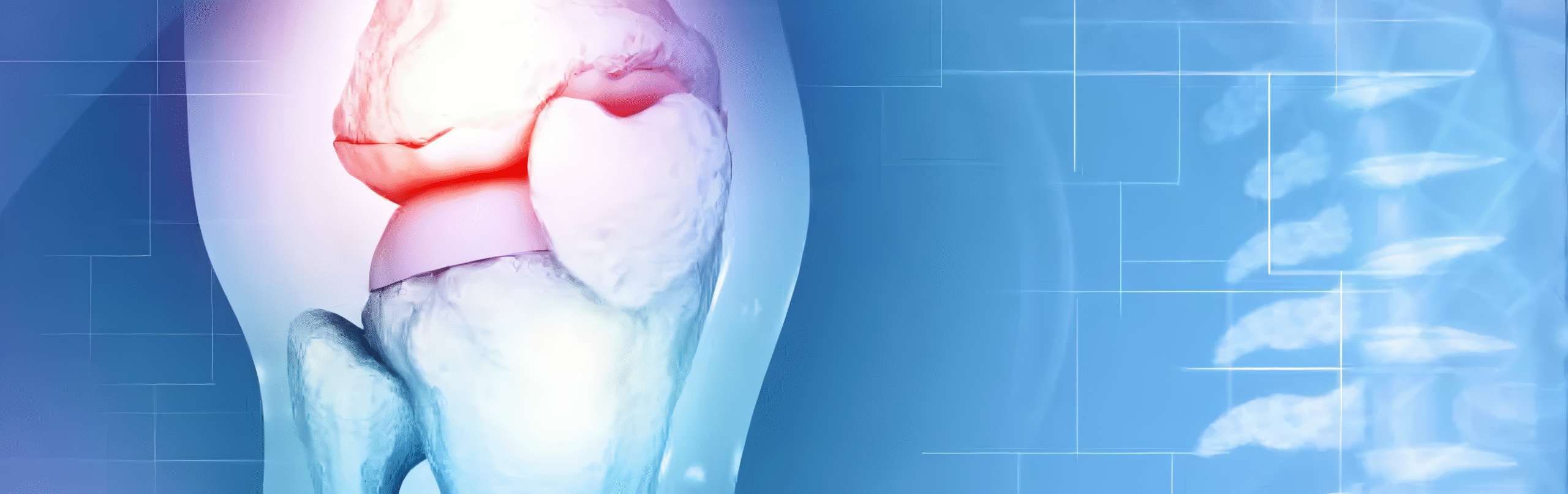 Knee Joint Pain Medical Imaging