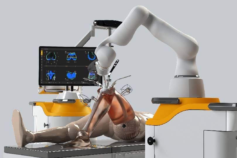 Robotic-Joint-Replacement1